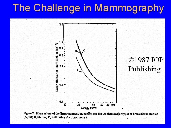 The Challenge in Mammography © 1987 IOP Publishing 