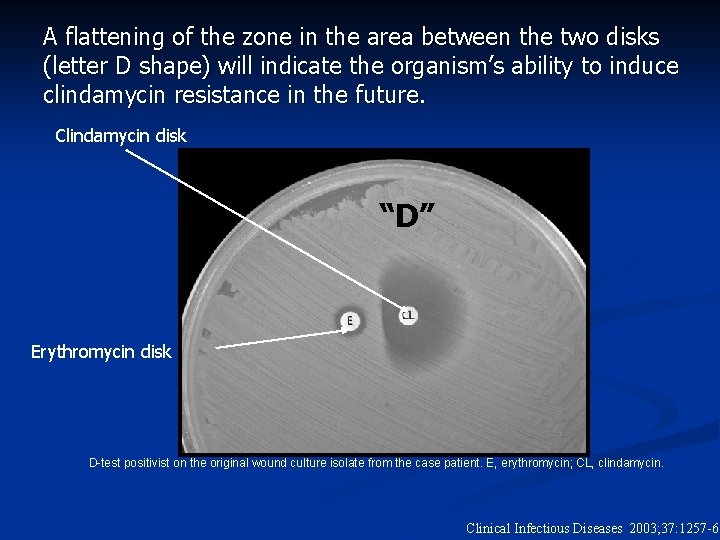 A flattening of the zone in the area between the two disks (letter D