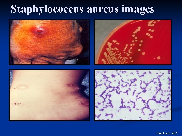 Staphylococcus aureus images Health info. 2005 
