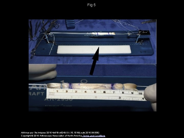 Fig 5 Arthroscopy Techniques 2015 4 e 619 -e 624 DOI: (10. 1016/j. eats.
