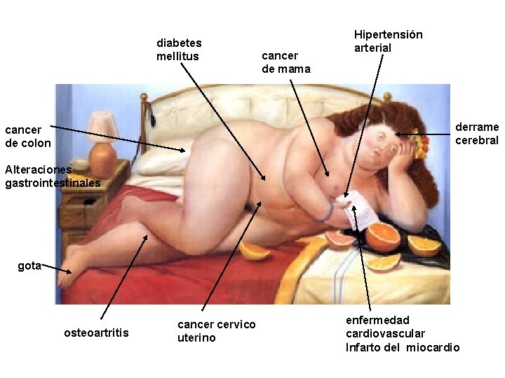 diabetes mellitus cancer de mama Hipertensión arterial derrame cerebral cancer de colon Alteraciones gastrointestinales