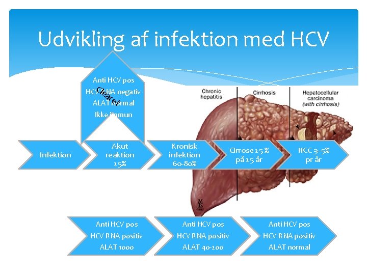 Udvikling af infektion med HCV Anti HCV pos Cle HCV RNA negativ ar et Udvikling af infektion med HCV Anti HCV pos Cle HCV RNA negativ ar et