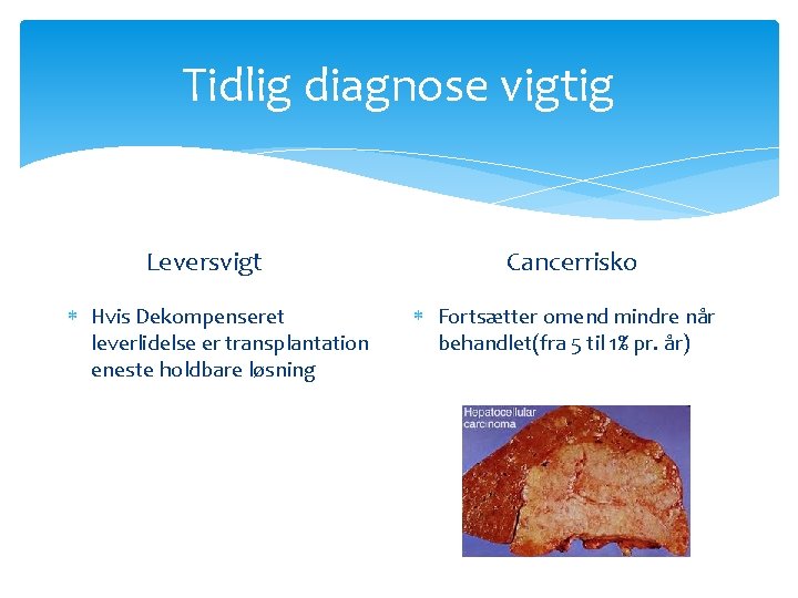 Tidlig diagnose vigtig Leversvigt Hvis Dekompenseret leverlidelse er transplantation eneste holdbare løsning Cancerrisko Fortsætter Tidlig diagnose vigtig Leversvigt Hvis Dekompenseret leverlidelse er transplantation eneste holdbare løsning Cancerrisko Fortsætter