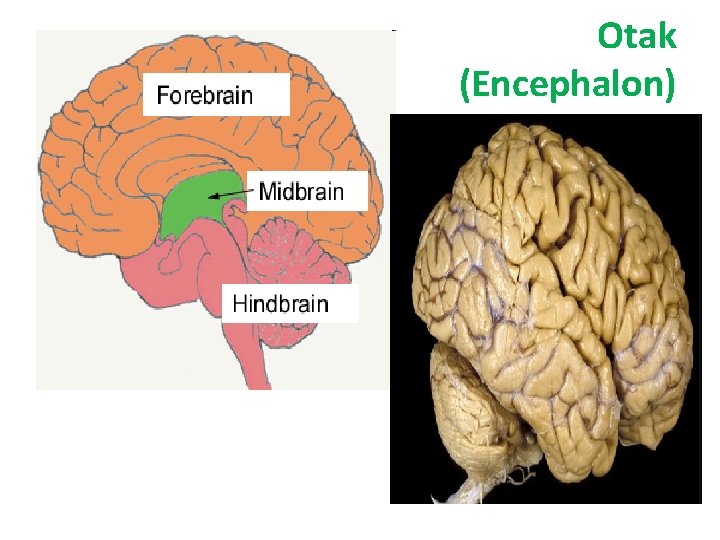 Otak (Encephalon) 