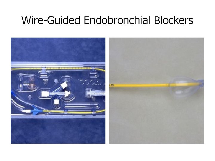 Wire-Guided Endobronchial Blockers 