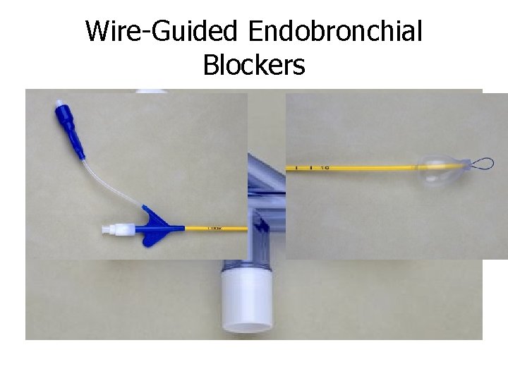 Wire-Guided Endobronchial Blockers 