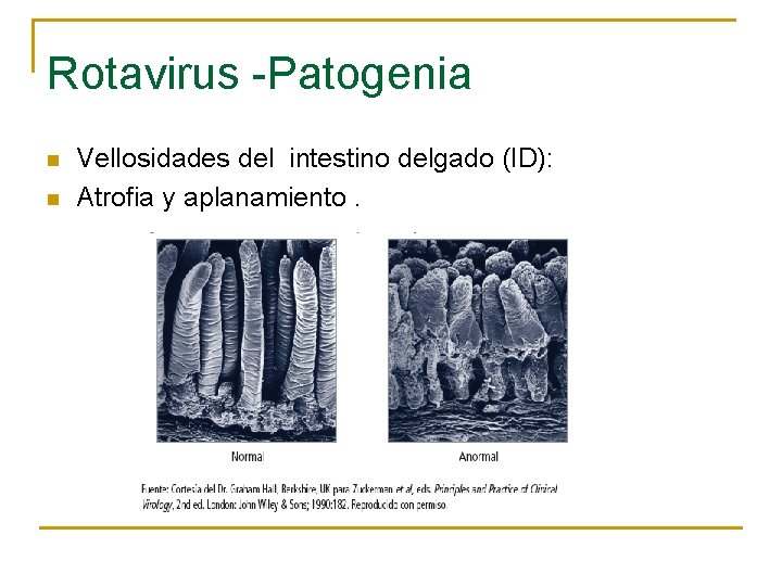 Rotavirus -Patogenia n n Vellosidades del intestino delgado (ID): Atrofia y aplanamiento. 