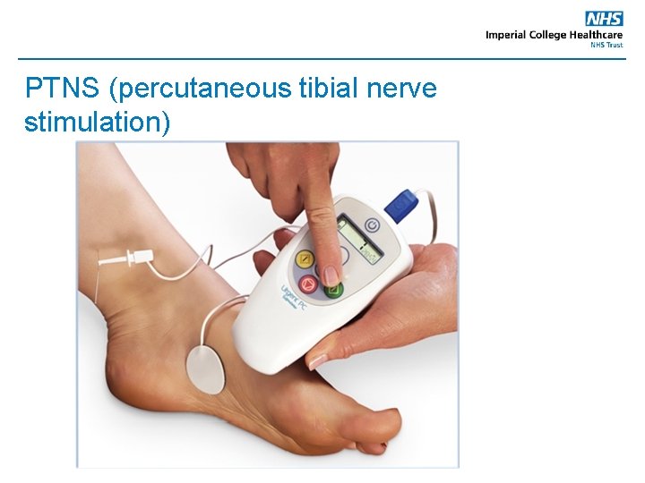 PTNS (percutaneous tibial nerve stimulation) 