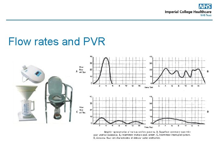 Flow rates and PVR 