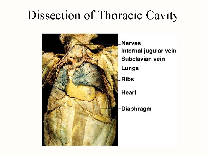 Dissection of Thoracic Cavity 