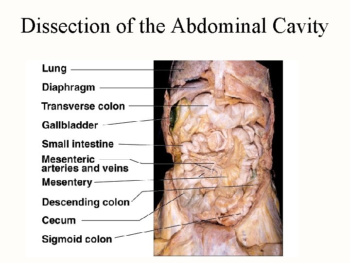 Dissection of the Abdominal Cavity 