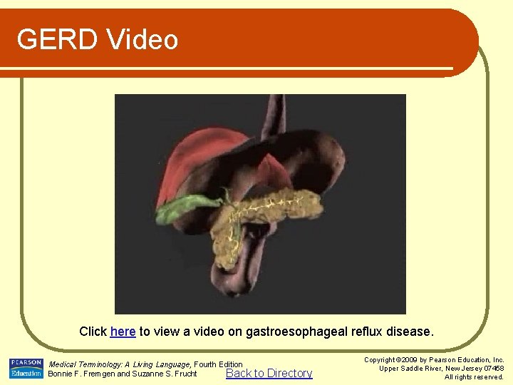 GERD Video Click here to view a video on gastroesophageal reflux disease. Medical Terminology: GERD Video Click here to view a video on gastroesophageal reflux disease. Medical Terminology: