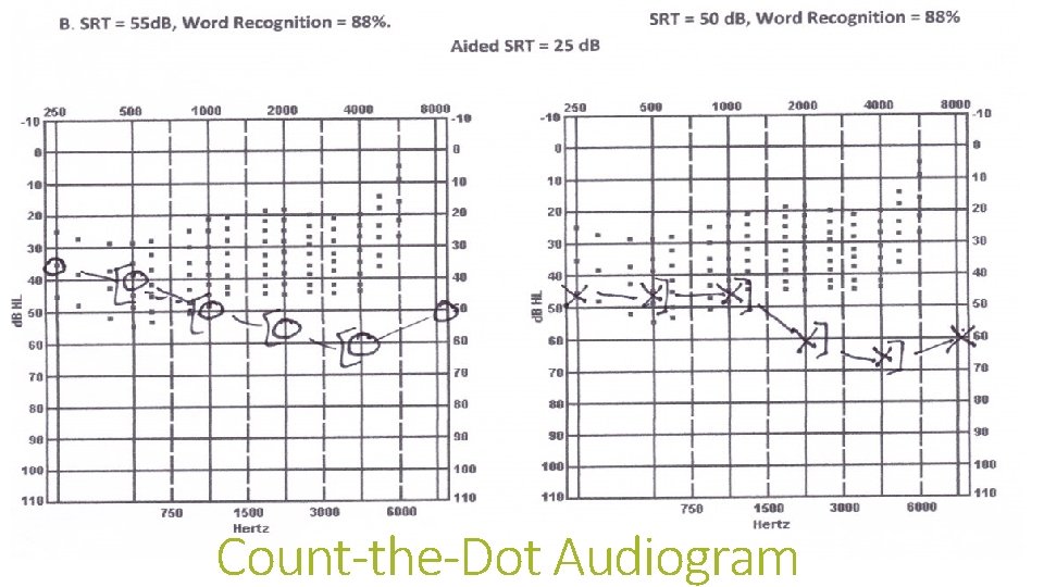 Count-the-Dot Audiogram 