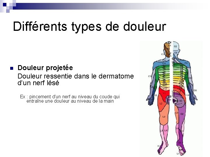 Différents types de douleur n Douleur projetée Douleur ressentie dans le dermatome d’un nerf Différents types de douleur n Douleur projetée Douleur ressentie dans le dermatome d’un nerf