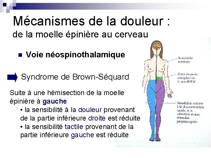 Mécanismes de la douleur : de la moelle épinière au cerveau n Voie néospinothalamique Mécanismes de la douleur : de la moelle épinière au cerveau n Voie néospinothalamique