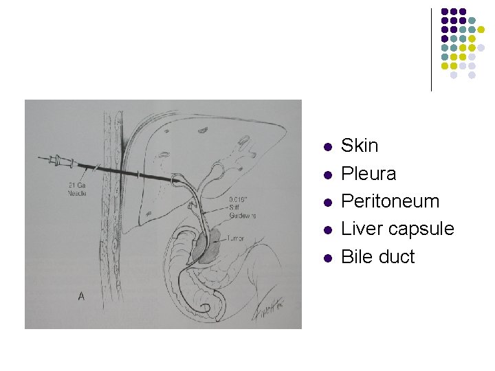 l l l Skin Pleura Peritoneum Liver capsule Bile duct 