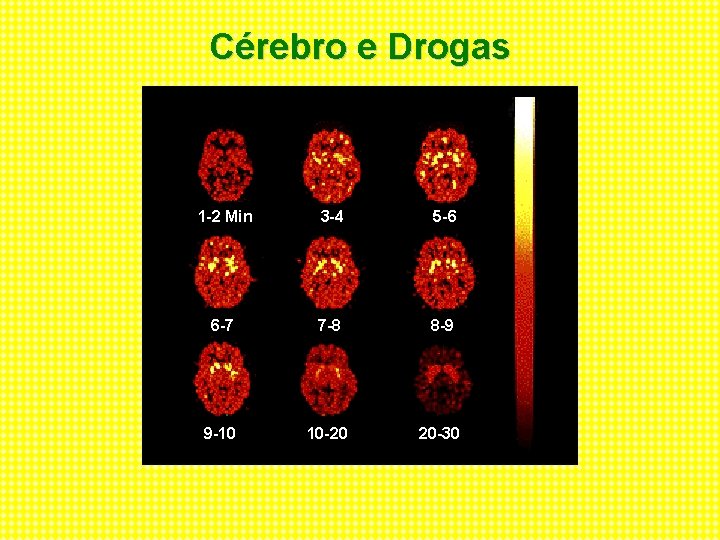 Cérebro e Drogas 1 -2 Min 3 -4 5 -6 6 -7 7 -8