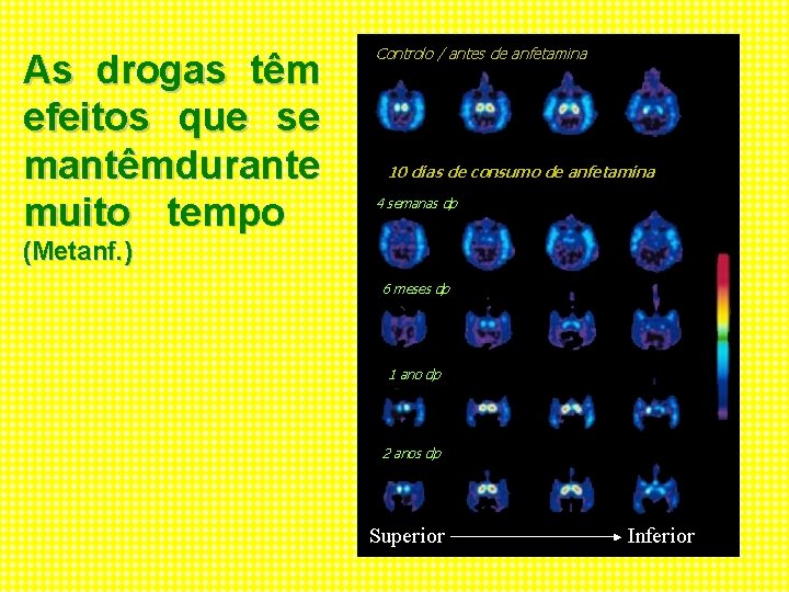 As drogas têm efeitos que se mantêmdurante muito tempo Controlo / antes de anfetamina