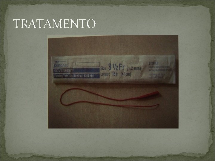 TRATAMENTO 