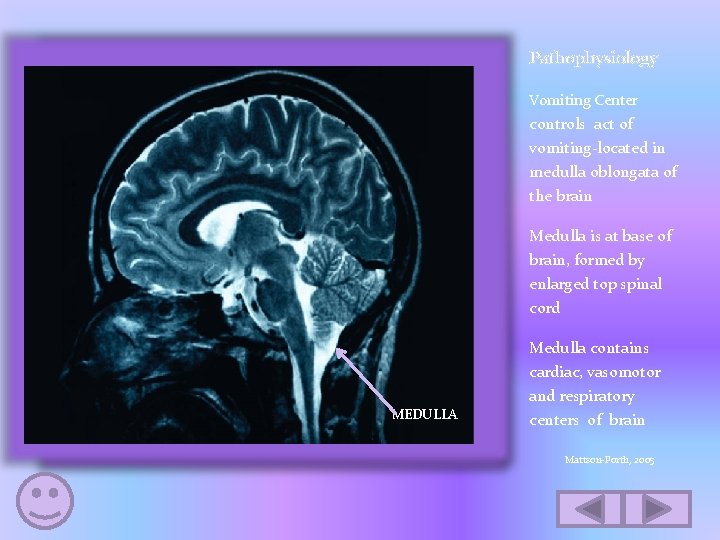 Pathophysiology Vomiting Center controls act of vomiting-located in medulla oblongata of the brain Medulla