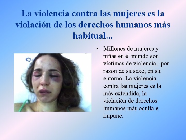 La violencia contra las mujeres es la violación de los derechos humanos más habitual.