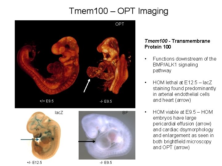 Tmem 100 – OPT Imaging OPT Tmem 100 - Transmembrane Protein 100 +/+ E