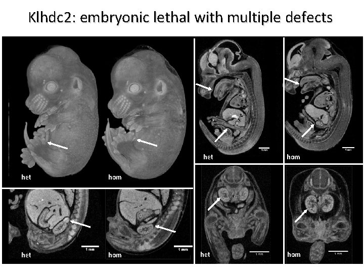 Klhdc 2: embryonic lethal with multiple defects het hom 