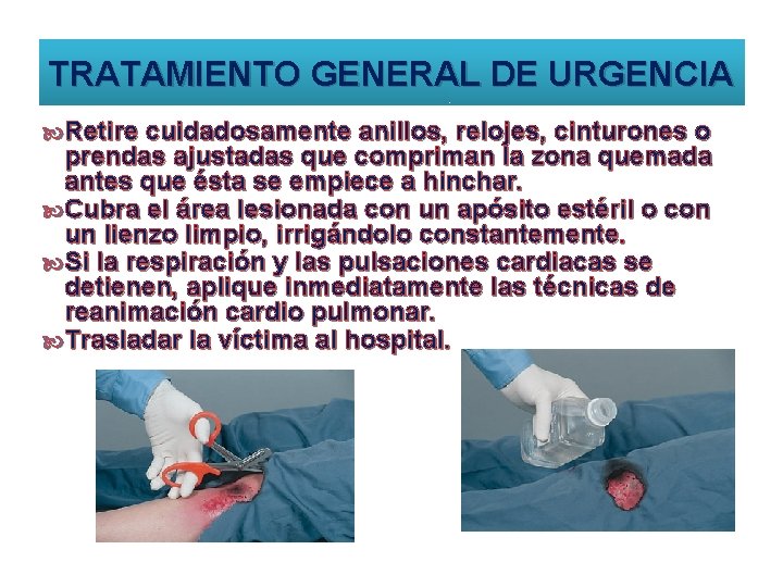 TRATAMIENTO GENERAL DE URGENCIA Retire cuidadosamente anillos, relojes, cinturones o prendas ajustadas que compriman