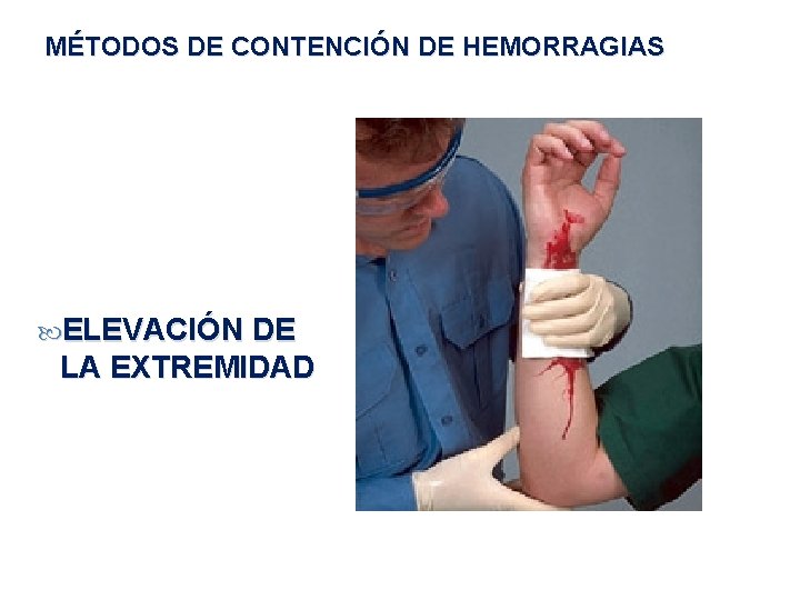 MÉTODOS DE CONTENCIÓN DE HEMORRAGIAS ELEVACIÓN DE LA EXTREMIDAD 