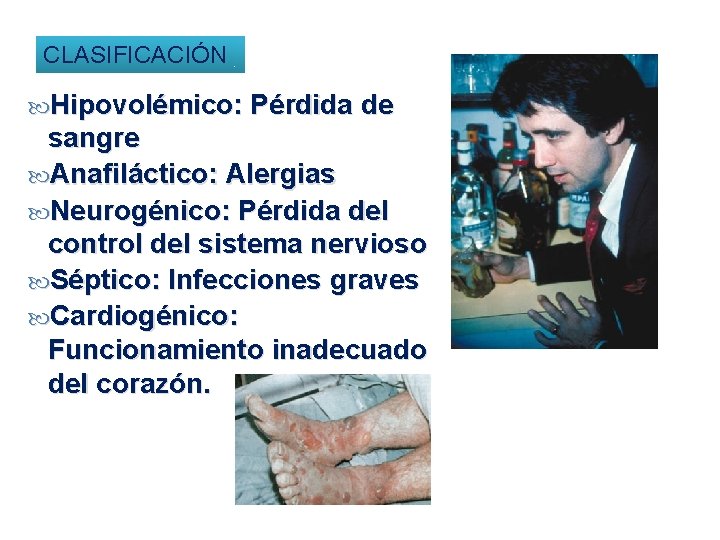 CLASIFICACIÓN Hipovolémico: Pérdida de sangre Anafiláctico: Alergias Neurogénico: Pérdida del control del sistema nervioso