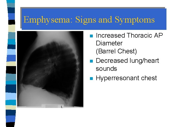 Emphysema: Signs and Symptoms n n n Increased Thoracic AP Diameter (Barrel Chest) Decreased