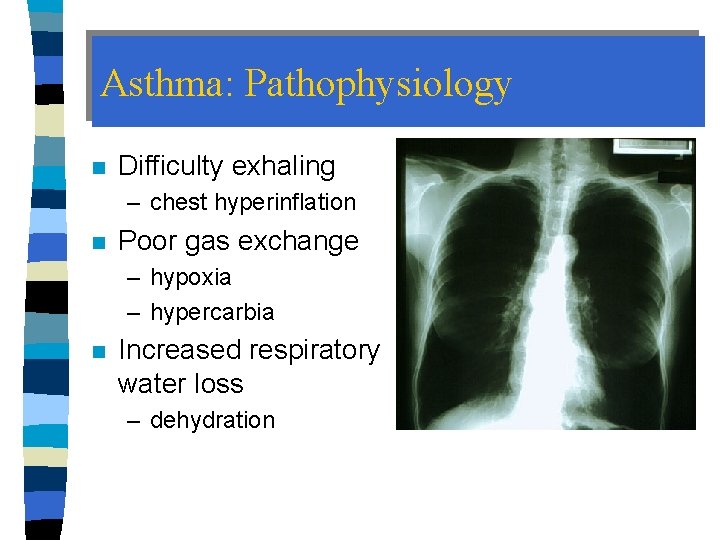 Asthma: Pathophysiology n Difficulty exhaling – chest hyperinflation n Poor gas exchange – hypoxia