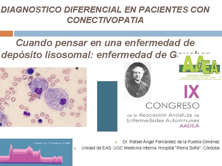 DIAGNOSTICO DIFERENCIAL EN PACIENTES CONECTIVOPATIA Cuando pensar en una enfermedad de depósito lisosomal: enfermedad