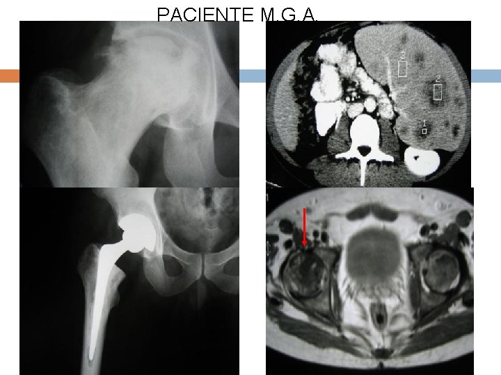 PACIENTE M. G. A. 
