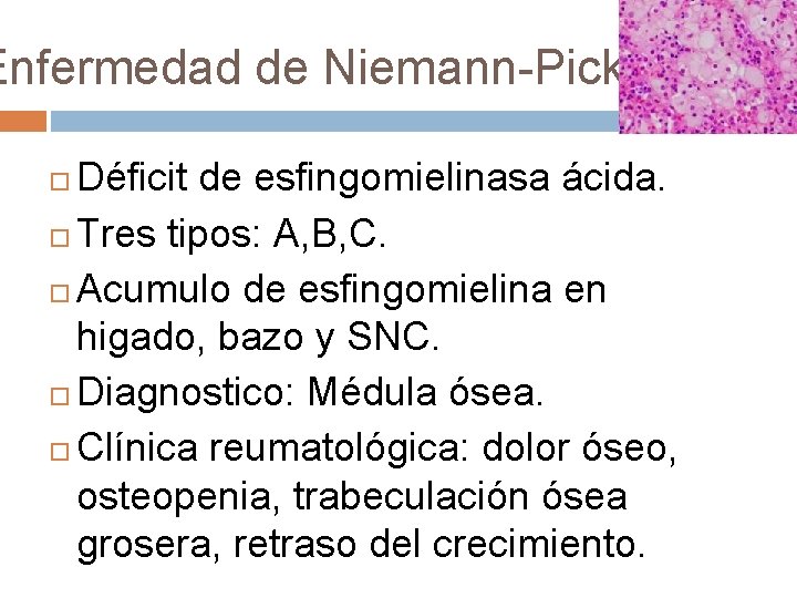 Enfermedad de Niemann-Pick Déficit de esfingomielinasa ácida. Tres tipos: A, B, C. Acumulo de