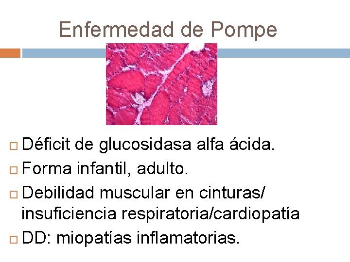 Enfermedad de Pompe Déficit de glucosidasa alfa ácida. Forma infantil, adulto. Debilidad muscular en