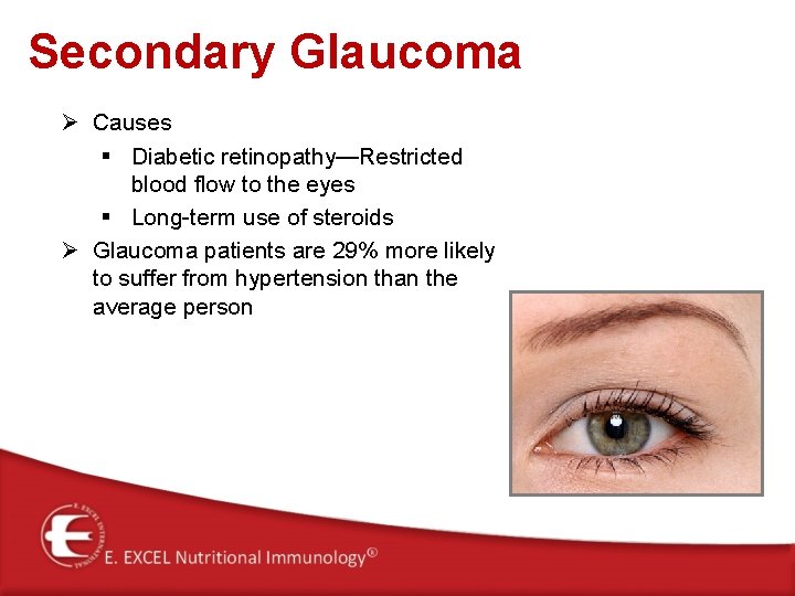 Secondary Glaucoma Ø Causes § Diabetic retinopathy—Restricted blood flow to the eyes § Long-term