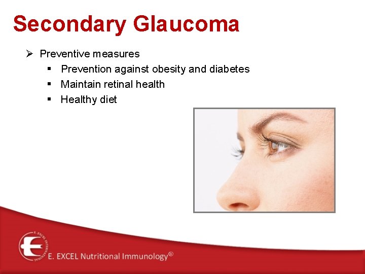 Secondary Glaucoma Ø Preventive measures § Prevention against obesity and diabetes § Maintain retinal