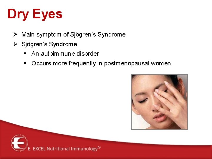 Dry Eyes Ø Main symptom of Sjögren’s Syndrome Ø Sjögren’s Syndrome § An autoimmune