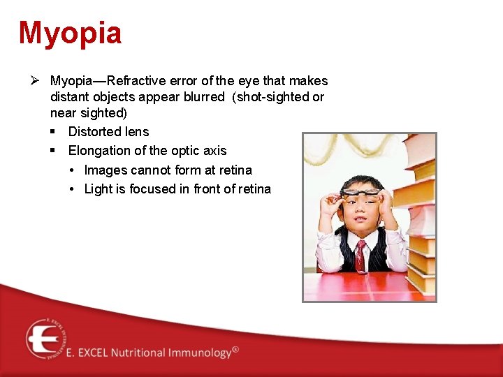 Myopia Ø Myopia—Refractive error of the eye that makes distant objects appear blurred (shot-sighted