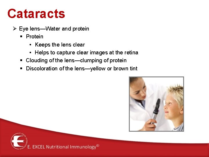 Cataracts Ø Eye lens—Water and protein § Protein • Keeps the lens clear •