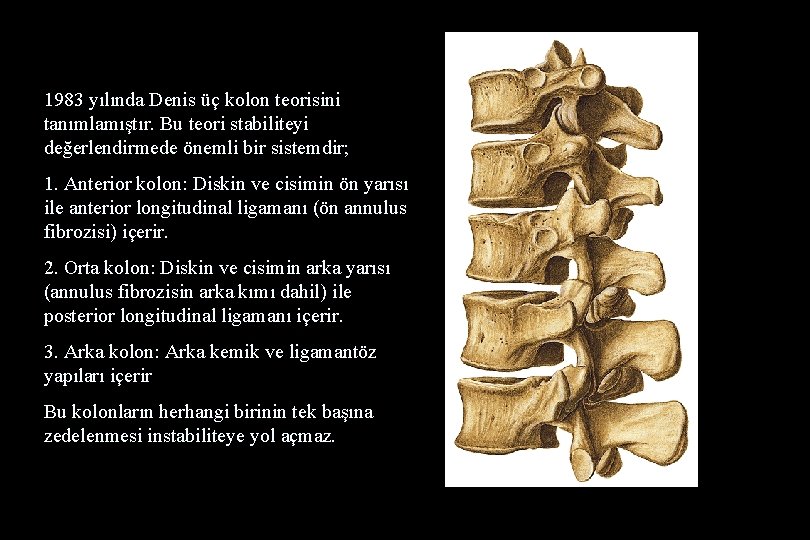 1983 yılında Denis üç kolon teorisini tanımlamıştır. Bu teori stabiliteyi değerlendirmede önemli bir sistemdir;