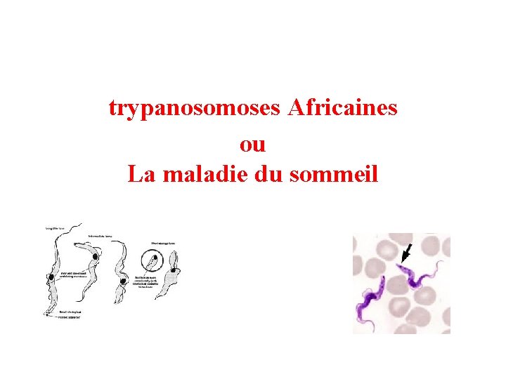 trypanosomoses Africaines ou La maladie du sommeil 