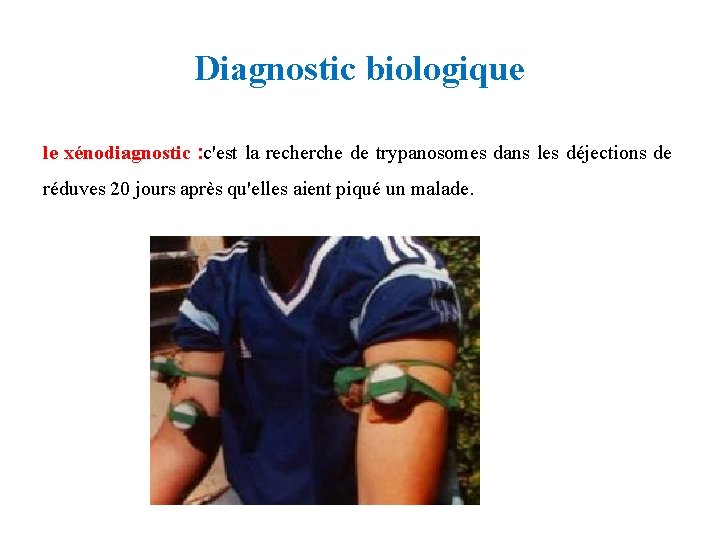 Diagnostic biologique le xénodiagnostic : c'est la recherche de trypanosomes dans les déjections de