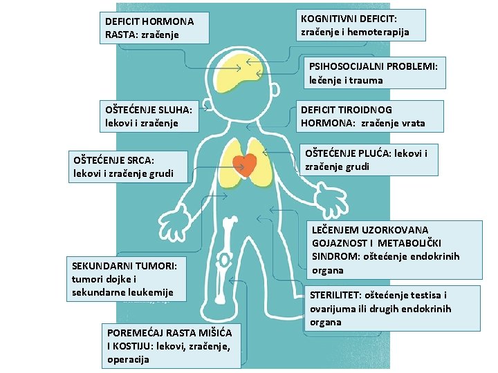 DEFICIT HORMONA RASTA: zračenje KOGNITIVNI DEFICIT: zračenje i hemoterapija PSIHOSOCIJALNI PROBLEMI: lečenje i trauma