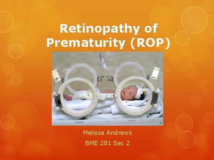 Retinopathy of Prematurity (ROP) Melissa Andrews BME 281 Sec 2 