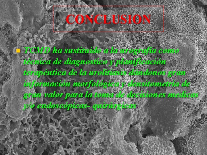 CONCLUSION n TCMD ha sustituido a la urografía como técnica de diagnostico y planificación