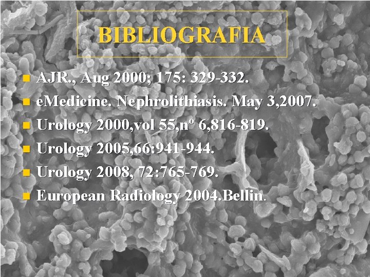 BIBLIOGRAFIA AJR. , Aug 2000; 175: 329 -332. n e. Medicine. Nephrolithiasis. May 3,