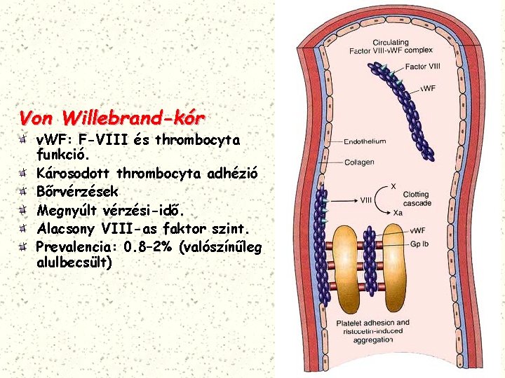 Von Willebrand-kór v. WF: F-VIII és thrombocyta funkció. Károsodott thrombocyta adhézió Bőrvérzések Megnyúlt vérzési-idő.