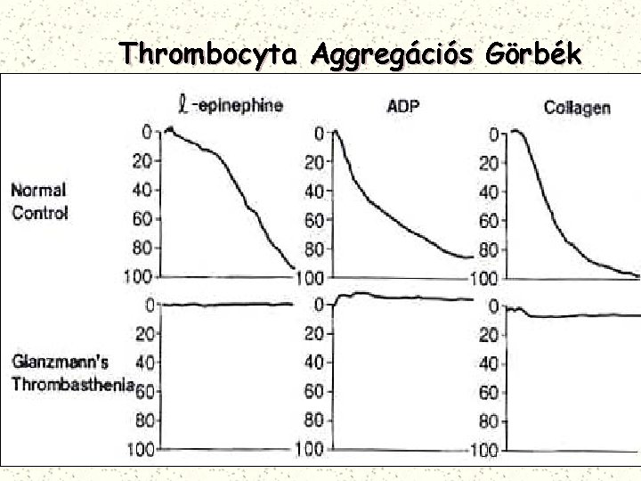 Thrombocyta Aggregációs Görbék 